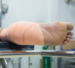 ניתוח תיקון מסתמים - תמונת המחשה